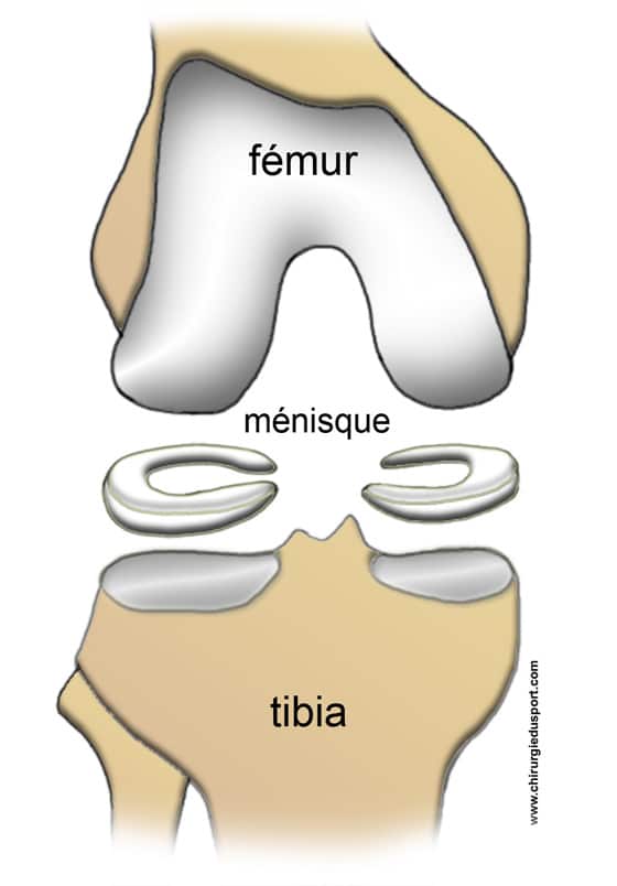 Ménisque fissuré, lésions, facture, déchirure – Chirurgie du Sport