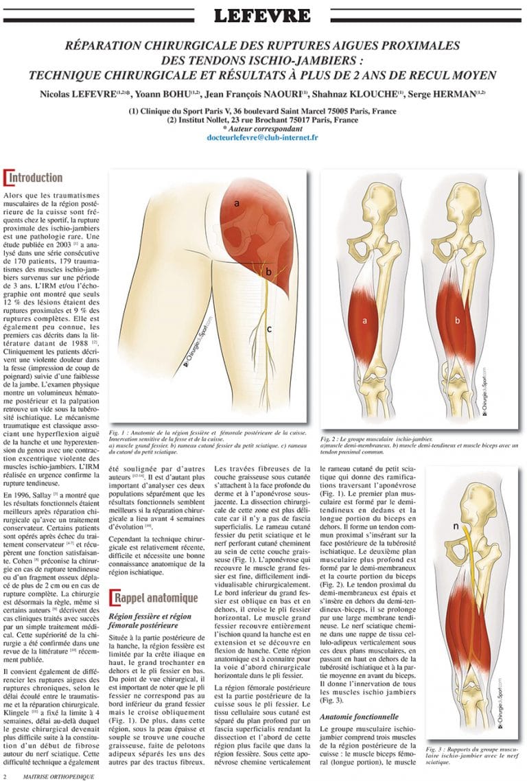 Ischio Jambiers – Chirurgie du Sport – Paris