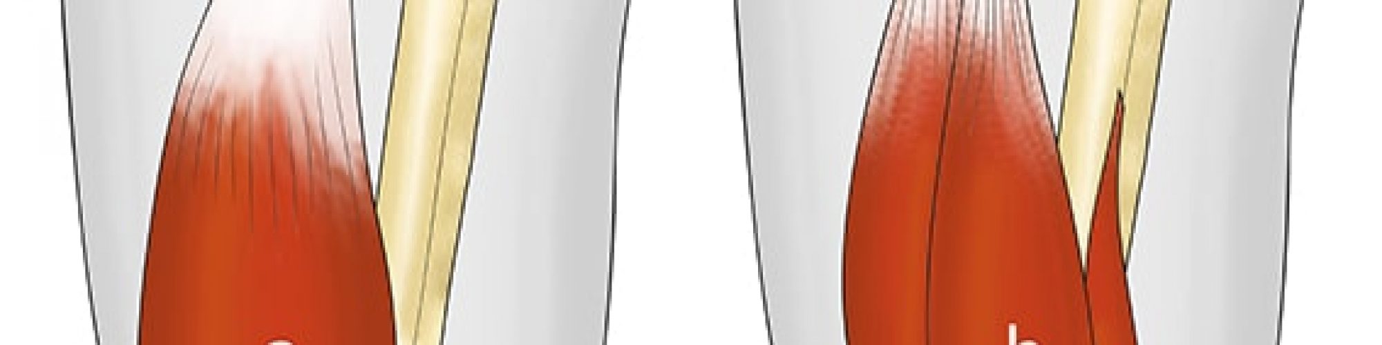 Fig_2_le_groupe_musculaire_ischio_jambier1
