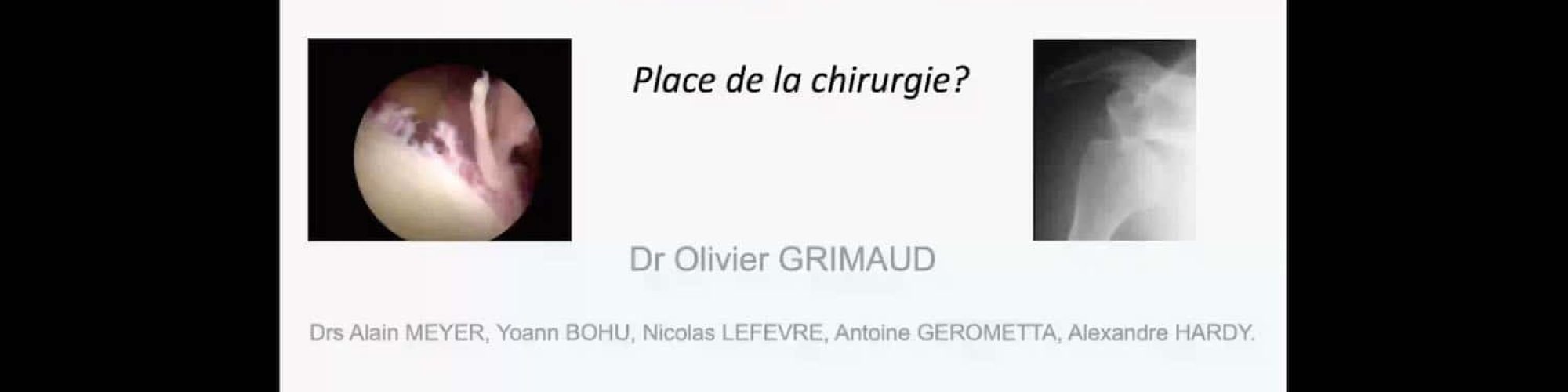 episode-epaule-grimaud