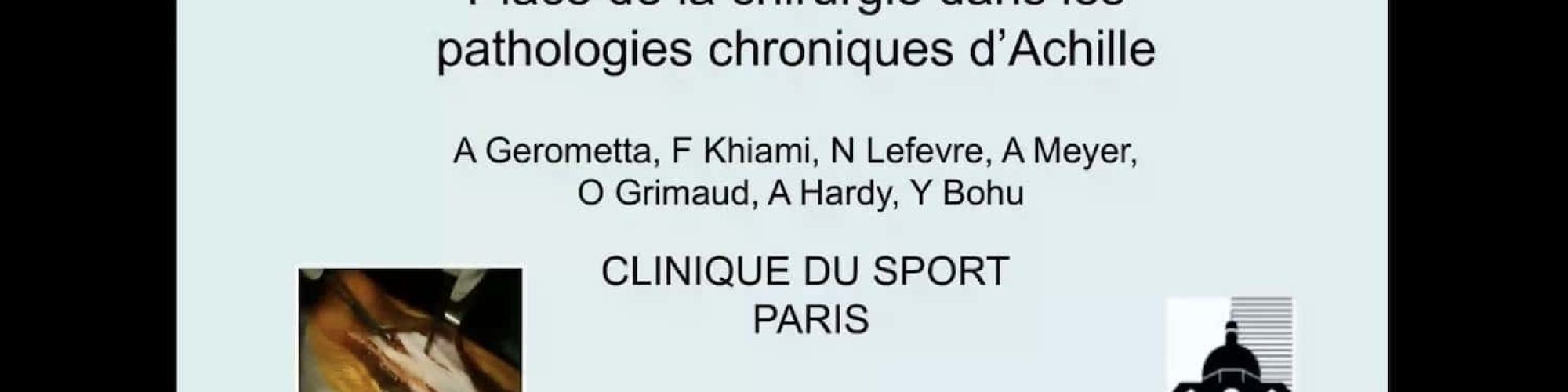 histoire-lca-bohu
